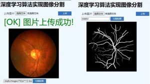 医学影像与图像分割:深度学习项目课-51自学联盟