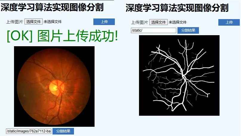 医学影像与图像分割：深度学习项目课百度网盘下载